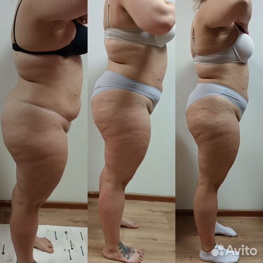 Вибро,вакуумный,вакуумно роликовый массаж