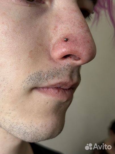 Пирсинг и микродермалы