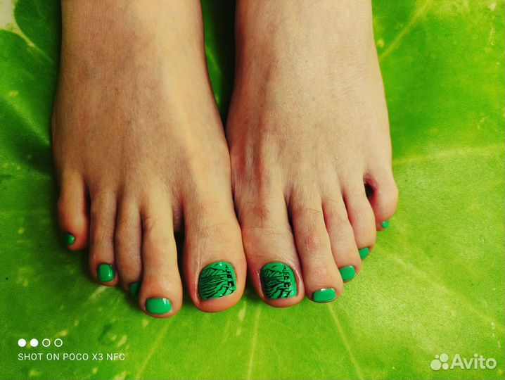 Педикюр мужской женский, подология, титановая нить