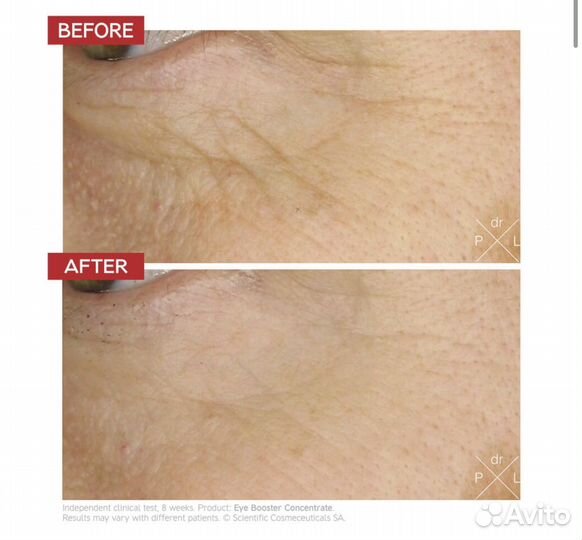 Концентрат под глаза Dr. Levy eye booster 7 мл