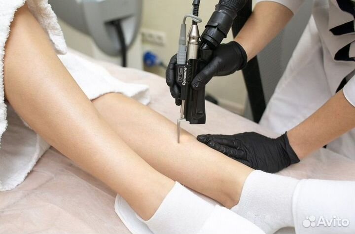 Готовый бизнес в сфере лазерной эпиляции