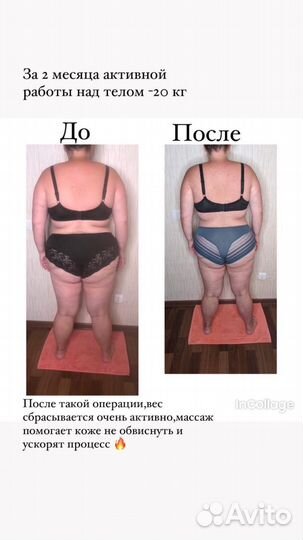 Антицеллюлитный массаж ручной