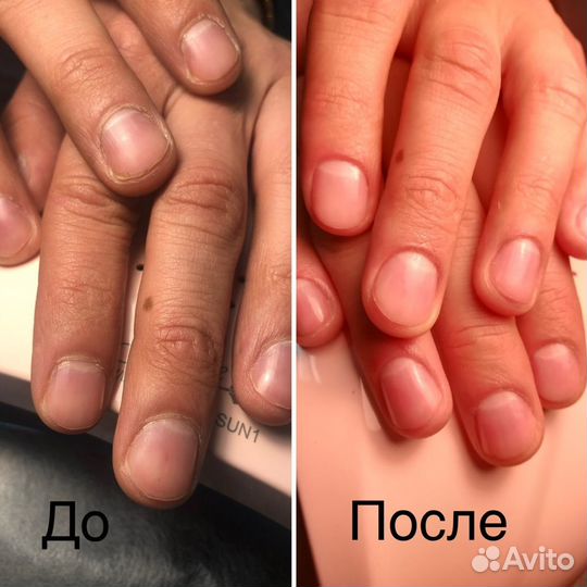 Подолог Мужской & Женский Маникюр и Педикюр