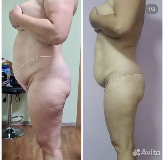 Массаж. Коррекция фигуры