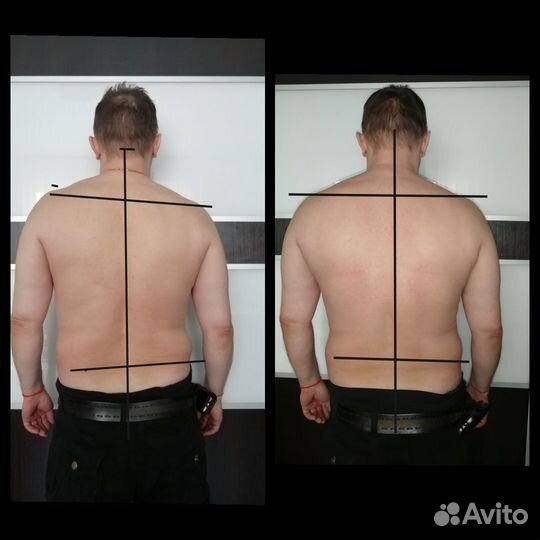 Правка тела