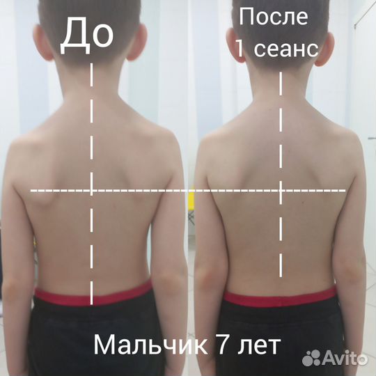 Остеопатическая коррекция, остеобаланс