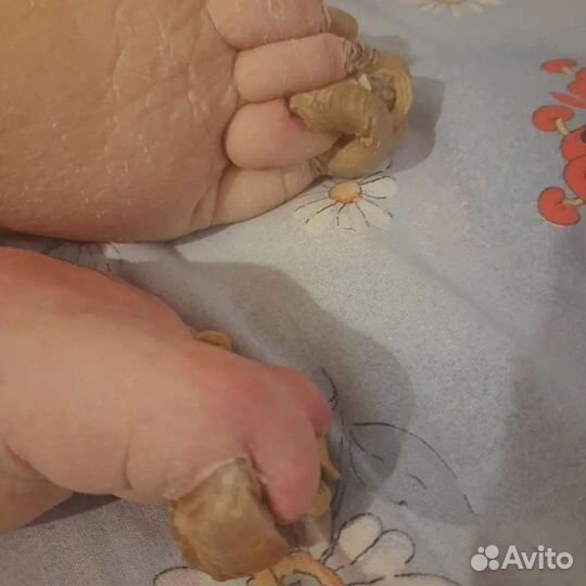 Педикюр(подолог)