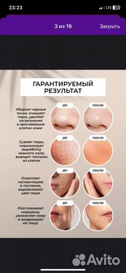 Ультразвуковая чистка лица