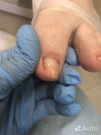 Подология, педикюр, маникюр