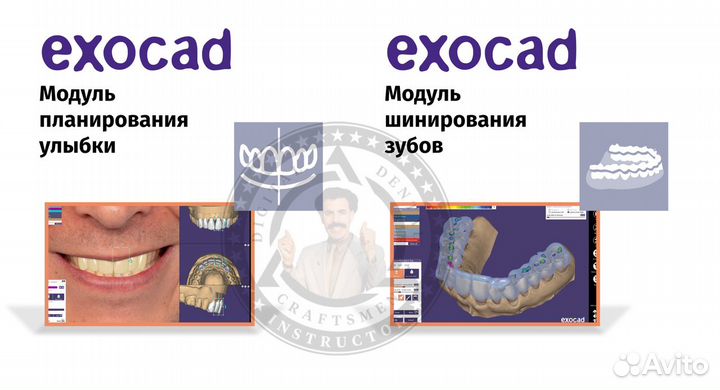 Exocad