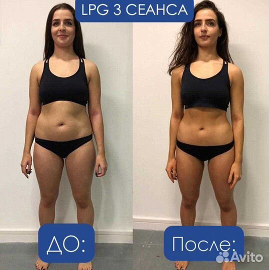 Лимфодренажный массаж