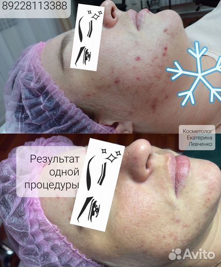 Косметолог. Сорочинск