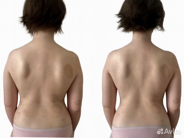 Массаж. Телесная терапия Пушкин