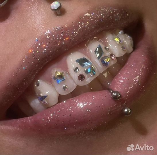 Установка скайсов