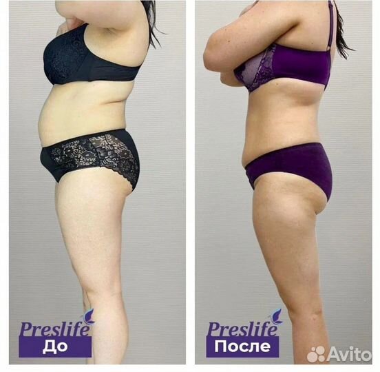 Похудение 16 процедур