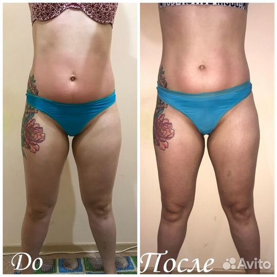 Антицеллюлитный массаж ручной