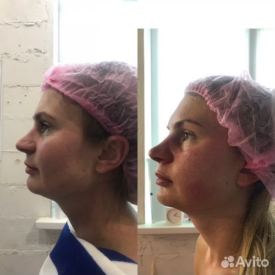 Оксана массажист