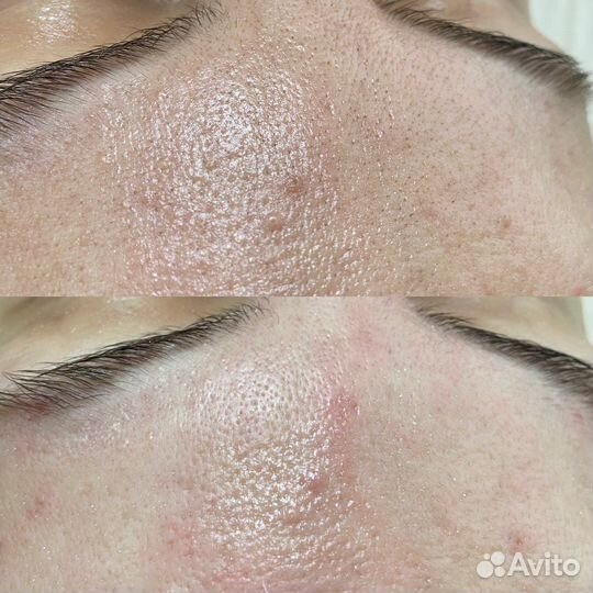 Услуги косметолога