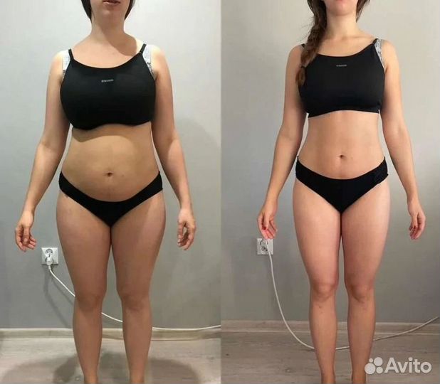 Плоский живот - размер за 1 процедуру в Перми