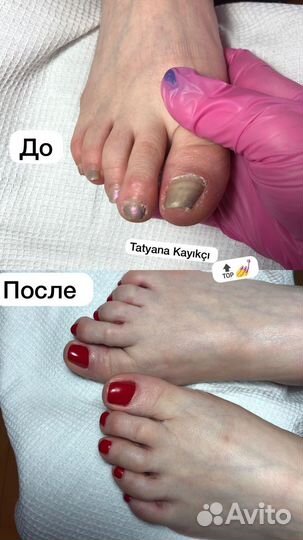 Наращивание