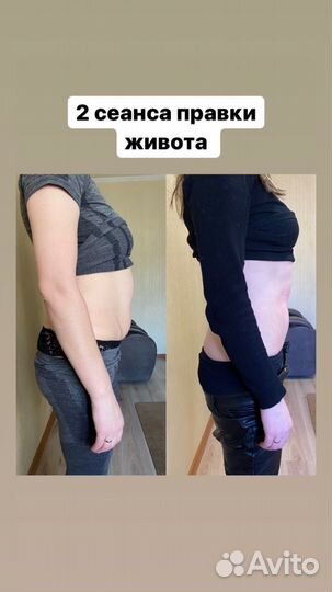 Костоправ массаж остеопат Коррекция осанки