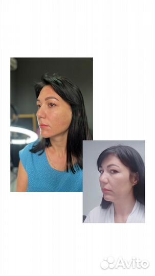 Консультация косметолога