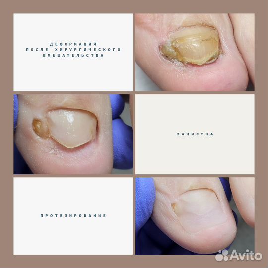 Услуги подолога