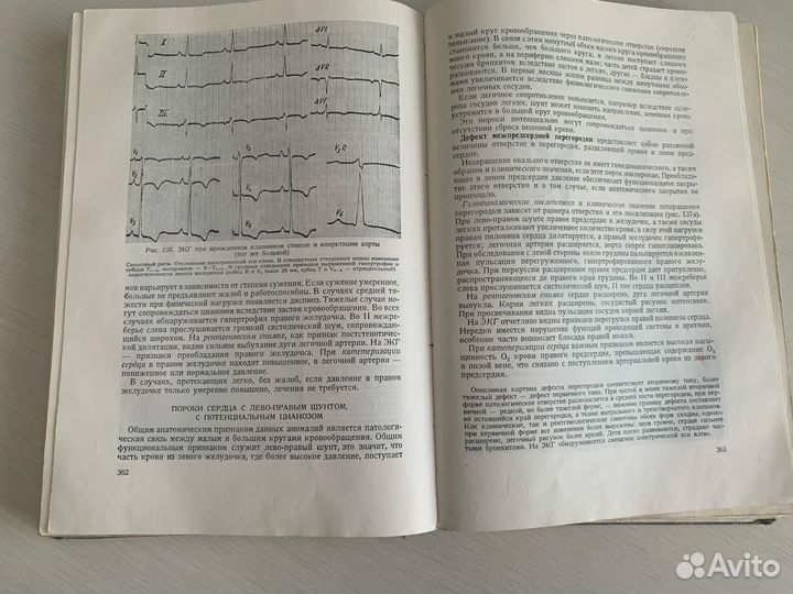 Педиатрия Э. Керпель-Фрониус 1977 г