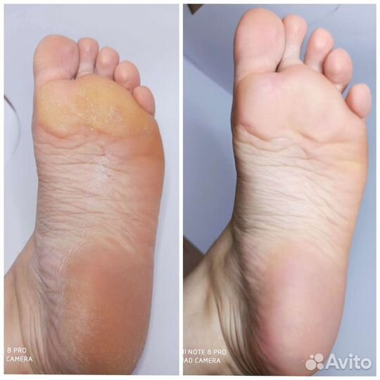 Маникюр. Педикюр. Дизайн ногтей. Наращивание ресни