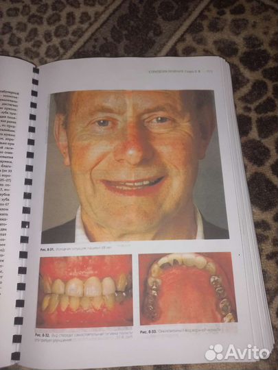 Протезирование с опорой на имплантаты книга