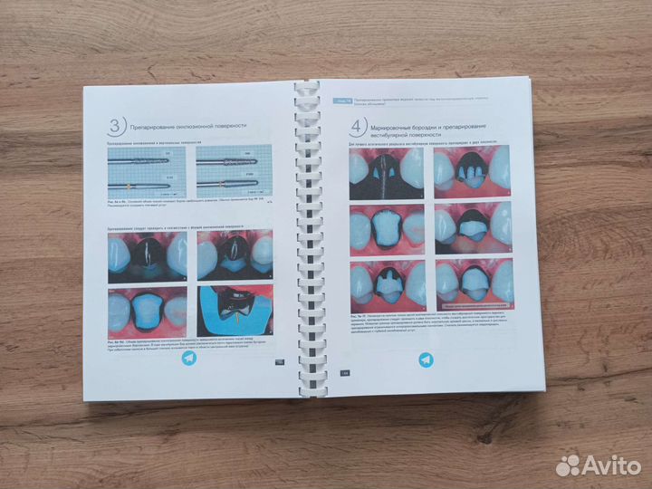 Несъемное протезирование зубов Йошиюки Хагивара