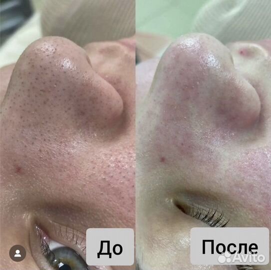 Услуги косметолога