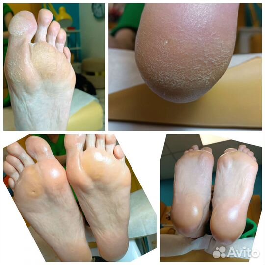 Маникюр и педикюр подолог