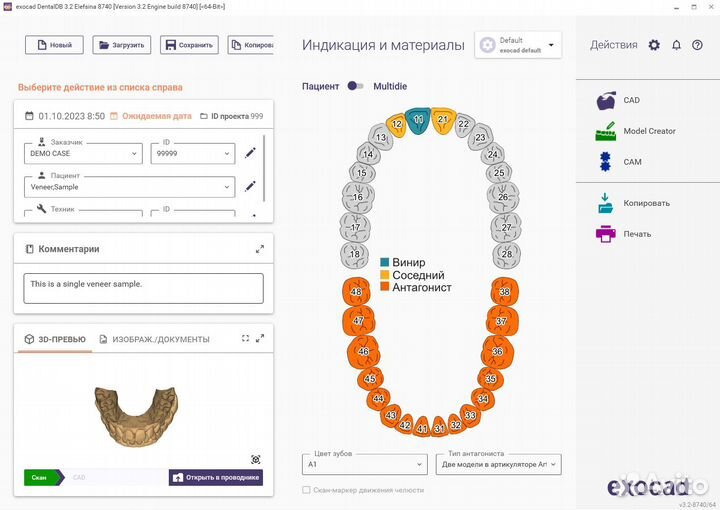 Exocad 3.2 Elefsina 8820 (24.02.2024)