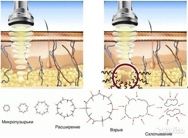 Спа массаж Багуа
