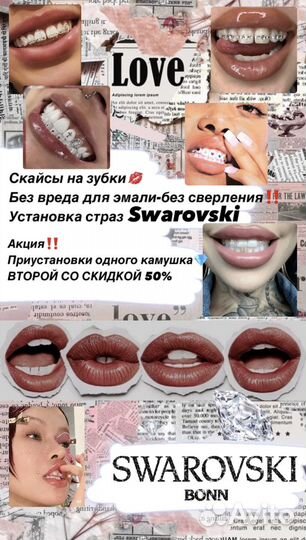 Скайсы на зубы/ установка страз Swarovski
