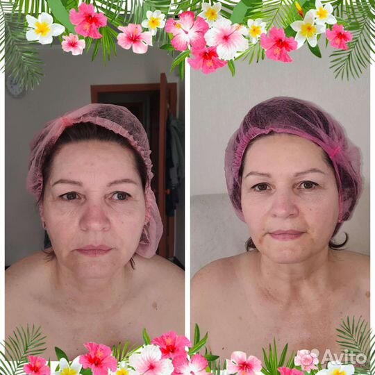 Массаж лица и тела