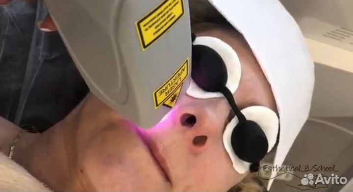 Лазерная эпиляция диодный лазер