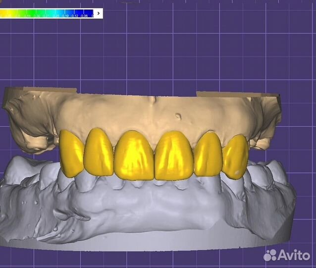 Зубной техник