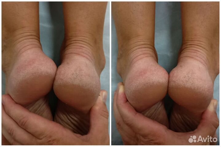 Мануальный массаж Анапа