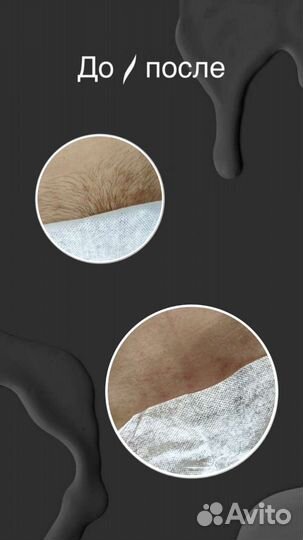 Шугаринг на дому