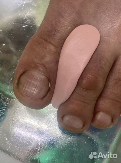 Педикюр проблемных стоп и ногтей (Подолог)