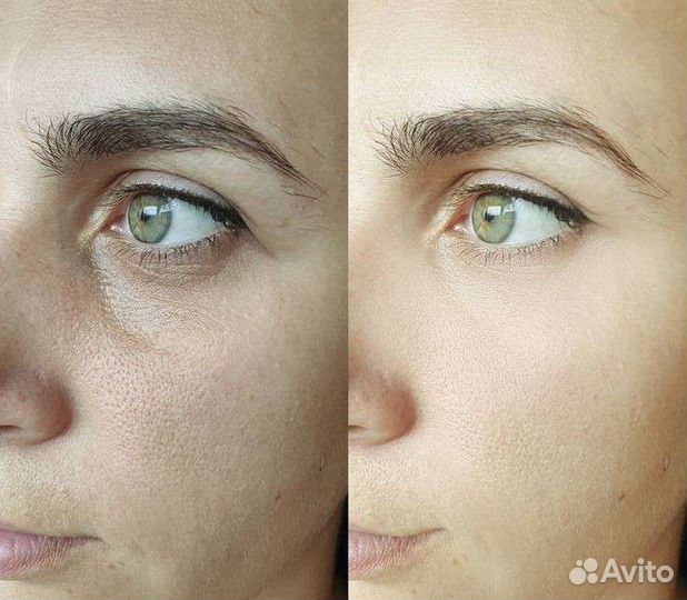 Скульптурный массаж лица