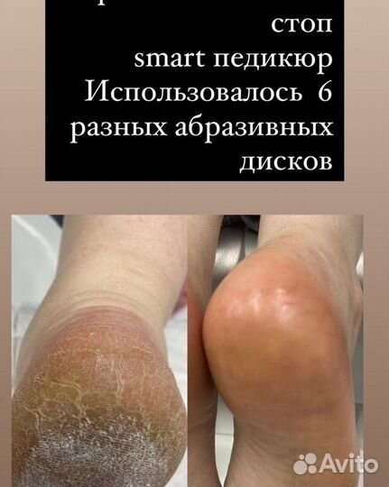 Ищу Модель на SMART Педикюр с покрытием