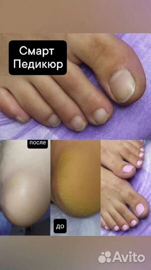 Детский маникюр