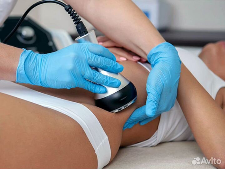 Модель на криолиполиз