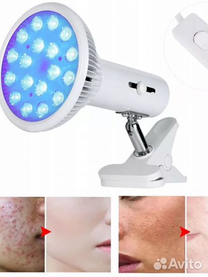 Фотолампа от желтушки