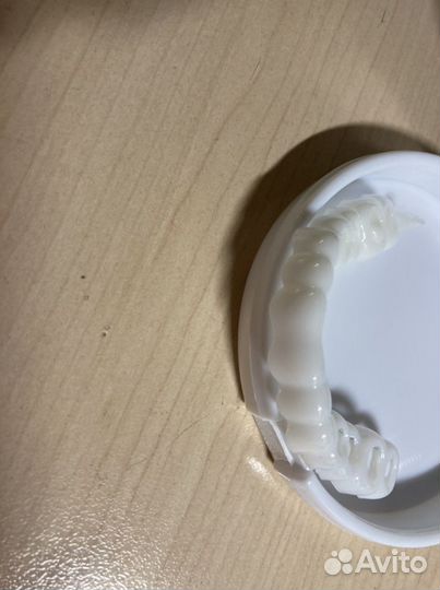 Виниры на зубы