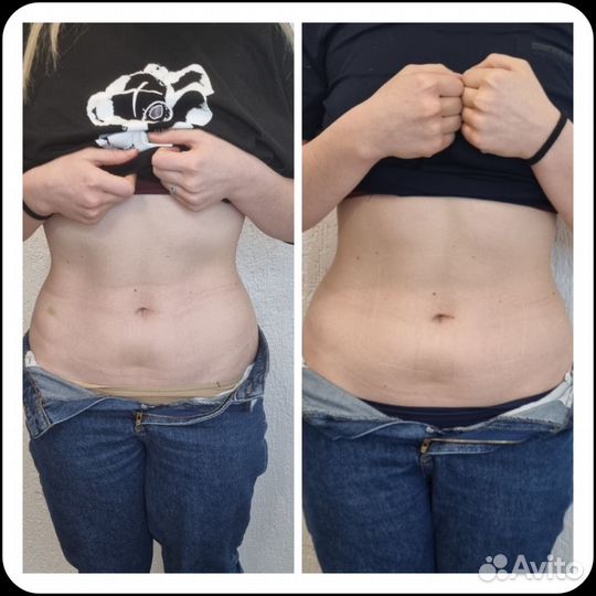 Антицеллюлитный массаж ручной