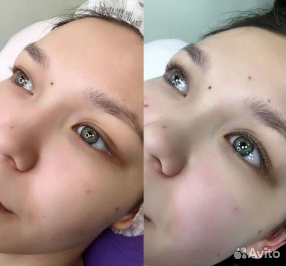 Ресницы и брови